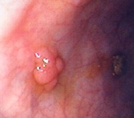 teeth_removal icon